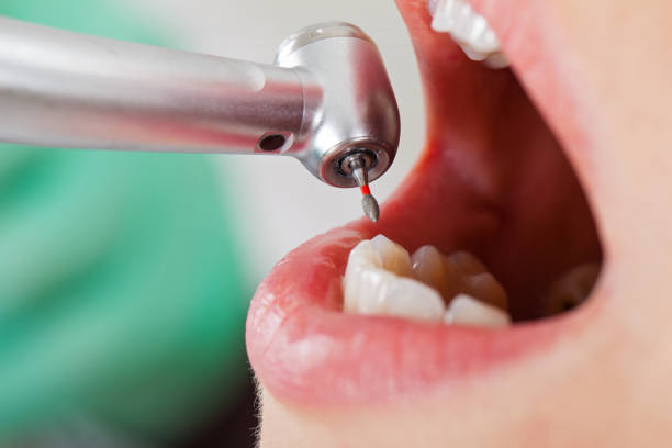 Best Emergency TMJ Treatment in Heartland, TX